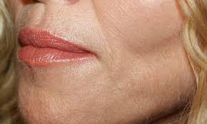 It contains vitamin c which helps to bleach the skin easily. How To Get Rid Of Facial Hair Naturally And Effectively