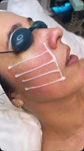 𝐌𝐈𝐋𝐀𝐆𝐑𝐎𝐒 𝐒Á𝐍𝐂𝐇𝐄𝐙 |𝐌𝐞𝐝𝐢𝐜𝐚𝐥 𝐄𝐬𝐭𝐡𝐞𝐭𝐢𝐜𝐢𝐚𝐧  |𝐒𝐤𝐢𝐧 𝐂𝐚𝐫𝐞