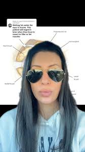 This is why it’s so important to go to a qualified provider when you are  seeking aesthetic treatments especially when it comes to energy based  devices!! , ., BECOME A PATIENT 👇🏻, @fortefacesinc , 📍 ...