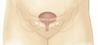Tot Or Tvt Virginia Beach Obgyn