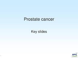It may grow slowly and it's typically treatable. Ppt Prostate Cancer Powerpoint Presentation Free Download Id 63791