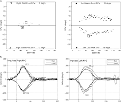 Image result for Horizontal Head Impulse Test