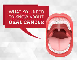 The oral cavity includes your lips, cheek lining, gums if you have any of these symptoms, let your dentist know, especially if you've had them for two weeks or more. Oral Cancer United Concordia
