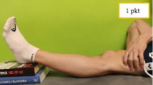 W ramach tego zespołu, grupa choroby, które opierają się na defekcie kolagenu, który jest podstawą tkanka łączna. Wiotkosc Stawow Czy Przeprost Kolan Jest Zly Fizjoklinika