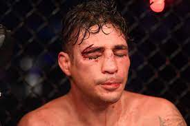 Diego sanchez's wife was the title bernadette sanchez held until 2019. Joshua Fabia On Sanchez Split Diego Has Clearly Been Taking Advantage Of Me For Two Years Bloody Elbow