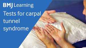 Tests For Carpal Tunnel Syndrome - Youtube