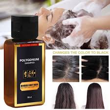 Albinism is a genetic abnormality in which little or no pigment is found in human hair, eyes, and skin. Buy Grey Reverse Hair Color Shampoo Multiflorum Anti Dandruff Shampoo Anti Hair Loss Moisturizing Refreshing Black Hair Care 30ml At Affordable Prices Free Shipping Real Reviews With Photos Joom