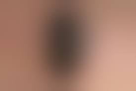 Открытая рана