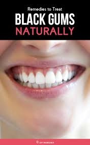 The Best Way To Avoid Darkening Of Gums Is To Follow Proper Oral Hygiene And Bring About Some Positive Changes In Your Lifestyle Dark Gums Black Gums Gum Care
