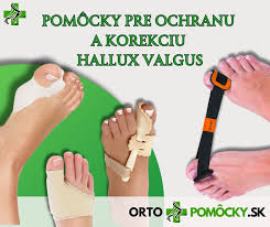 Image result for vybočený palec ortéza