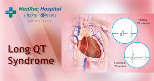 Image result for QT Interval