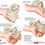 Image result for Allen Test