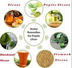 How do doctors treat peptic ulcer disease? Top 6 Herbal Remedies To Treat Ulcers Naturally Ulcer Diet Herbal Remedies Remedies