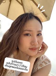 Before and After Phyto Hair Vitamins