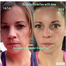 Skin Transformation with Consistent Routine