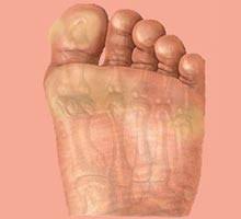 Callus And Eyes Of Fish Hipernatural Com