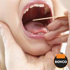 Anak demam secara berulang dan kurang selera makan? 3 Cara Mudah Hilangkan Bengkak Tonsil Info Kesihatan