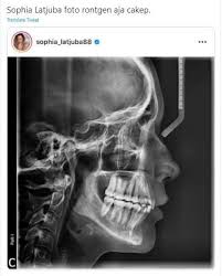 Check spelling or type a new query. Soal Soal Tes Radiologi Jawabanku Id