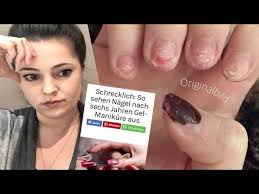Was kann ich dagegen tun? Schrecklich So Sehen Nagel Nach 6 Jahren Gelmanikure Aus Youtube