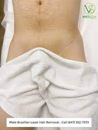 The treatment will remove hair on the intimate area, front of the pubic region and inner butts. Brazilian Laser Hair Removal For Men Vs Medspa Laser Clinic