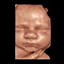 What a gorgeous little 3D Baby!