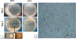 Image result for Buchnera candida