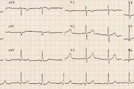 images?q=tbn:ANd9GcSJJ_iLl3qTq8bKmrRCLQk