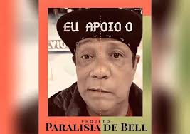 Los síntomas de la parálisis de bell incluyen una debilidad repentina en tus músculos faciales. Entenda A Paralisia De Bell Saude