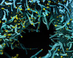 However, if you are single, you are hardly alone. I I Immunology Inflammation A Virtual Symposium On Covid 19 Mdc Berlin
