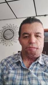 Nelson Garzon Vivir Es Vencer.