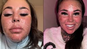 Woman frantic after getting stuck from attempting dangerous TikTok trend