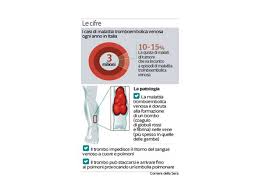 The emboli can be caused by: Tumore E Trombosi Le Cause E Le Terapie Per Scongiurare Il Problema Corriere It