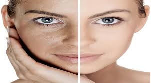 An individual's skin pigmentation is the result of genetics, being the product of both of the individual's biological parents' genetic makeup, and exposure to sun. Singh Skin Cure Clinic Skin Pigmentation