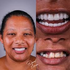 Dr. David Lincon (@dr.david_lincon) • Instagram photos and videos