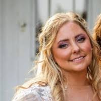 I decided to share my news to make coworkers aware of my upcoming surgery. 