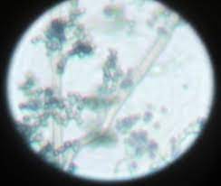 A similar piece of paper from an illustrated magazine: Microscopic View Of The Isolated Fungus At 40x Magnification Download Scientific Diagram