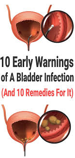 10 Early Warnings Of A Bladder Infection And 10 Remedies For It Urinary Tract Infection Remedies Bladder Infection Remedies Bladder