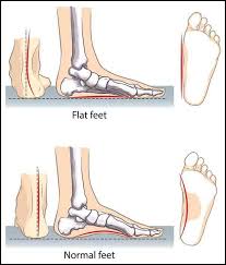 Pin On Shoes For Flat Feets
