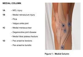 Image result for Patellar Apprehension Test