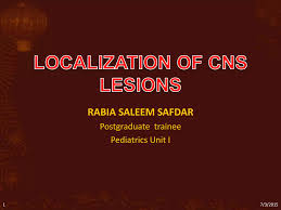 Image result for Neurologic Lesion Localization