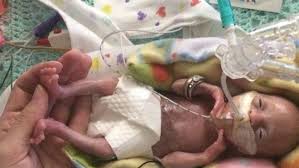 Estado* acre alagoas amapá amazonas bahia ceará distrito federal espírito santo goiás maranhão mato grosso mato grosso do sul minas. Mpf Es Quer Aborto Pos Estupro No Sus Apos 22 Semanas De Gestacao