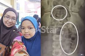 Kencing tak lawas adalah masalah yang membabitkan golongan lelaki dan perempuan. Tak Boleh Nak Urut Urut Sendiri Sangka Gastrik Akhirnya Usus Besar Anak Penuh Najis Ibu Bapa Jangan Terkejut Tahu Puncanya Viral Mstar