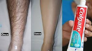 Istenmeyen Tuyler Ve Killar Icin Sasirtici Dis Macunu Ile Tuylerinizi Kalici Yok Edin Guzellik Youtube Vucut Yaglari Dogal Cilt Bakimi Epilasyon