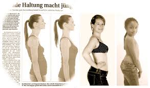 Apa itu slip disc ? Apa Itu Postural Sehat Lordosis