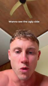 Bands are a cheat code — but only if you use them right. 🎯 They're  incredible for calisthenics when used with purpose: ✔️ warm-up & protect  your shoulders ✔️ make tough skills