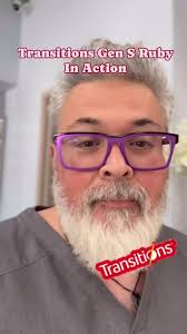 The new Transitions lenses in Ruby is pure 🔥🔥.