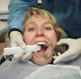 Mouth Prop - an overview | ScienceDirect Topics