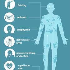 Mast Cell Activation Syndrome: Symptoms, Causes, Diagnosis, And Treatment