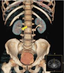 Symptoms Listen To How Your Stone Is Communicating With You Abdominal Key