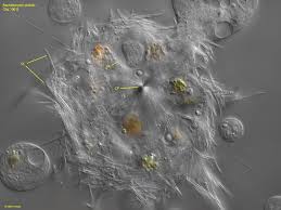 Image result for Raphidiocystis